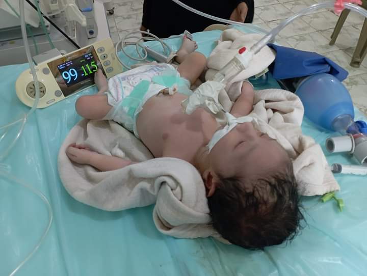 انقاذ طفلًا بعد تعرضه لاختناق أثناء الولادة بلحج