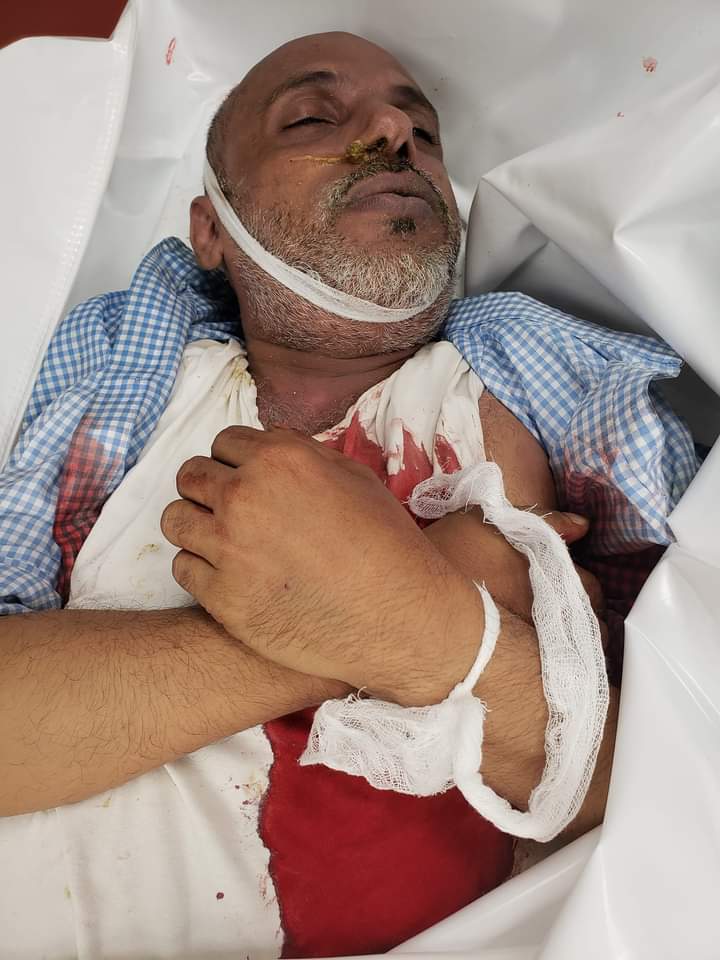 مقتل مسن وإصابة طفل باستهداف حوثي لحي سكني بتعز