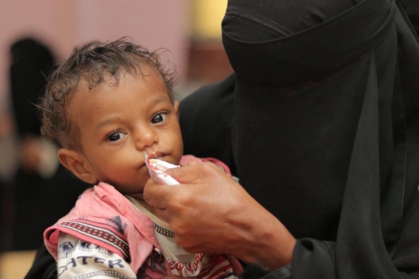 اليمن يحصل على أكثر من 4 ملايين دولار لمواجهة سوء التغذية